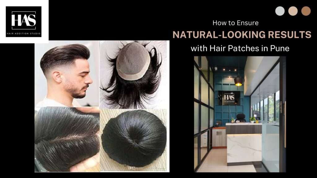 Hair Patches in Pune