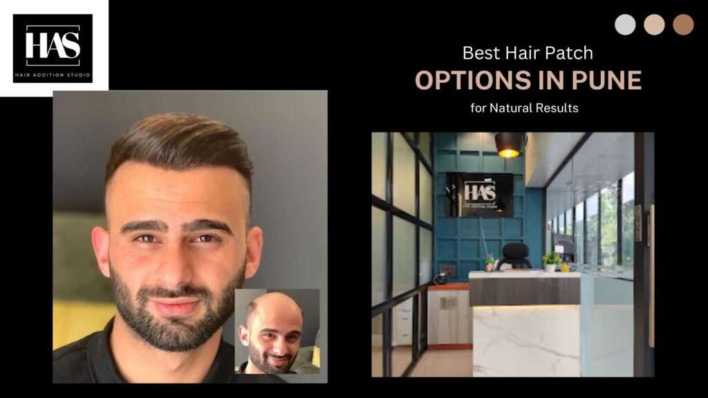 best hair patch